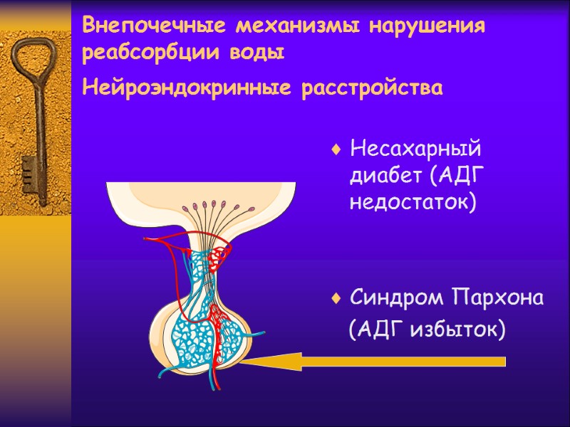 Внепочечные механизмы нарушения реабсорбции воды Нейроэндокринные расстройства   Несахарный диабет (АДГ недостаток) 